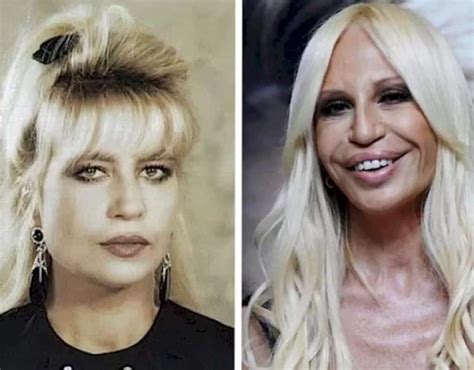 real face of versace|donatella versace face what happened.